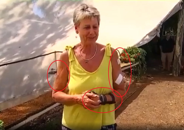 Carefree Kangaroo Breaks Into Home to Steal Food, Punches Homeowner So Hard She Ends Up in the Hospital 2 photo 1 15781260278901839563393