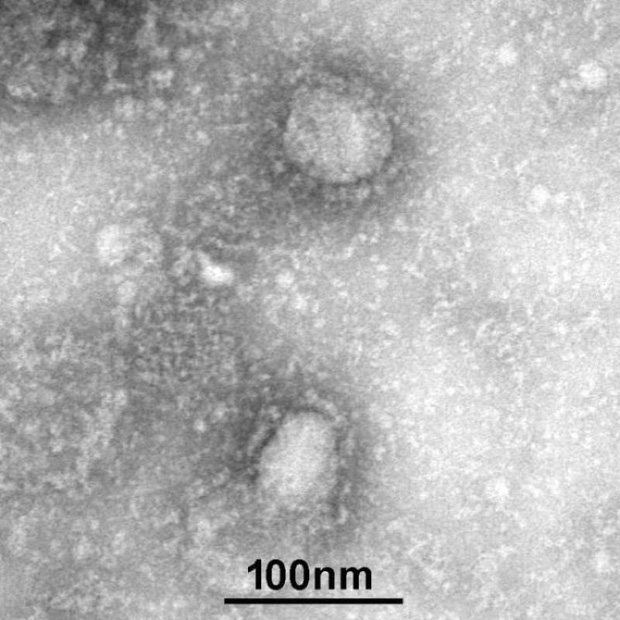 Wuhan coronavirus