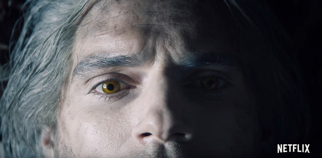 Henry Cavill's Eyes Were Nearly Damaged Due to Wearing Contact Lenses for Too Long While Filming The Witcher 3 Due to wearing contact lenses for too long and encountering dust, Henry was unable to open his eyes.