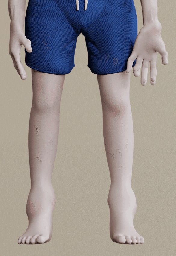 legs 158633314739710192956
