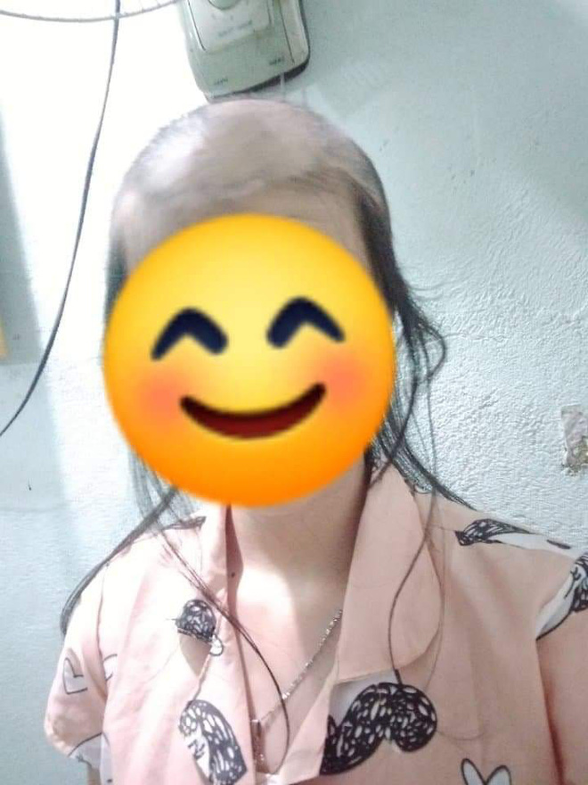 The girl has pulled out too much hair.