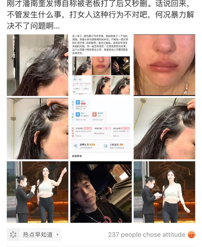 Recently, model and MC Ban Seo Jin caused a stir by accusing a CEO of brutally beating and abusing her. On her personal page, the Korean beauty posted images showing her bruised and swollen face as evidence.