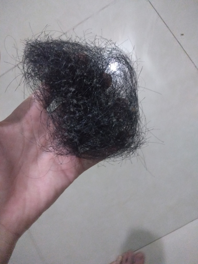Hair she pulled out in one night.