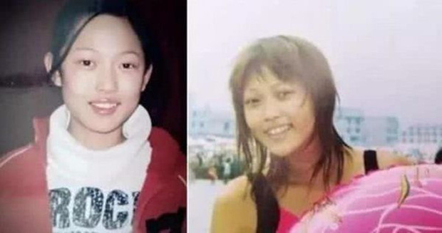 Abby's face gradually changed through various surgeries