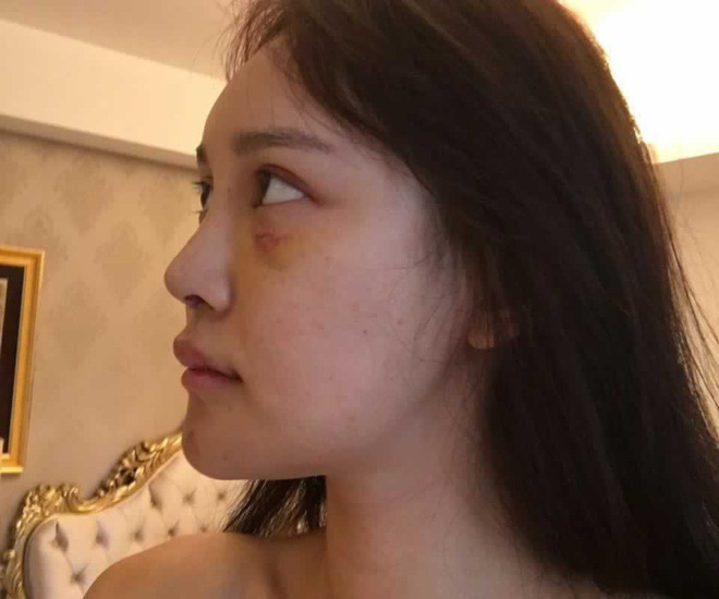 She is also not afraid to openly share images of her 'reconstructive' process