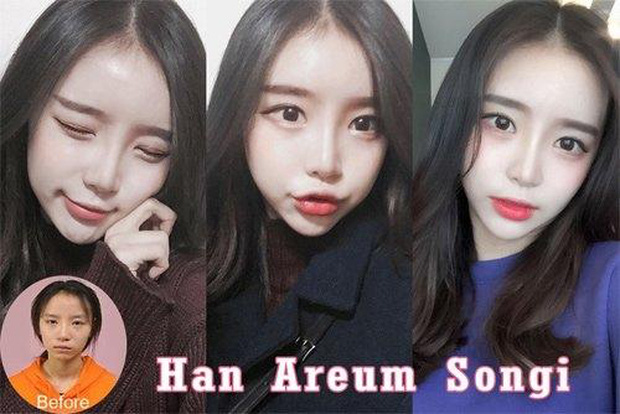 The perfect beauty of this hot girl turns out to be a product of cosmetic surgery