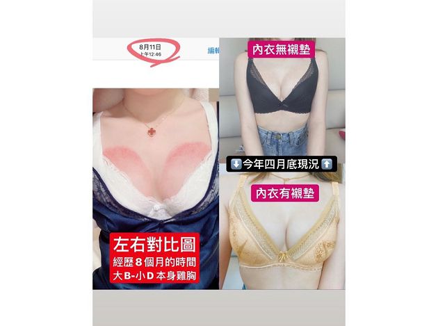 She posted a photo of her bust on Instagram to prove to her fans