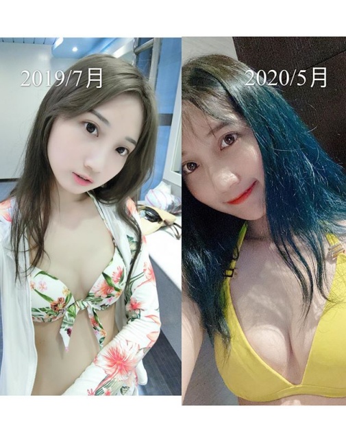 Indeed, if you make a comparison, there are quite a few differences in the breasts between the two photos even though the time is less than a year