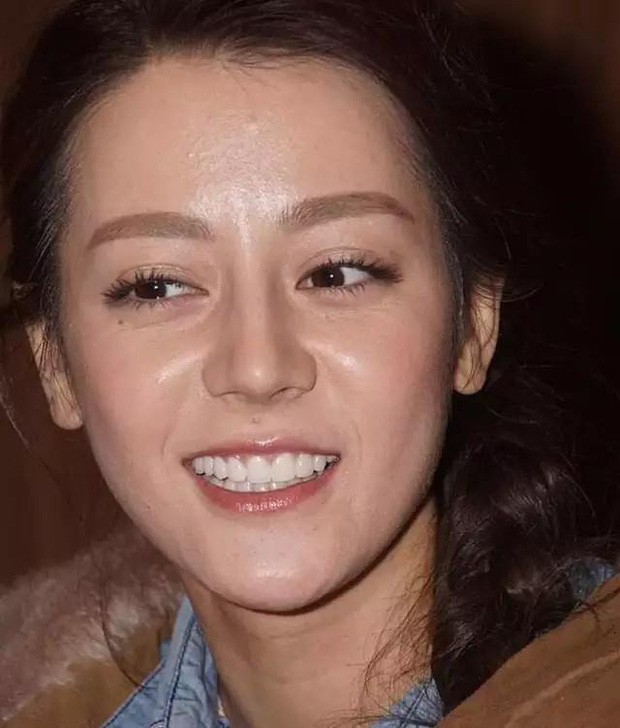 This is the real photo of the image showing the oily face above