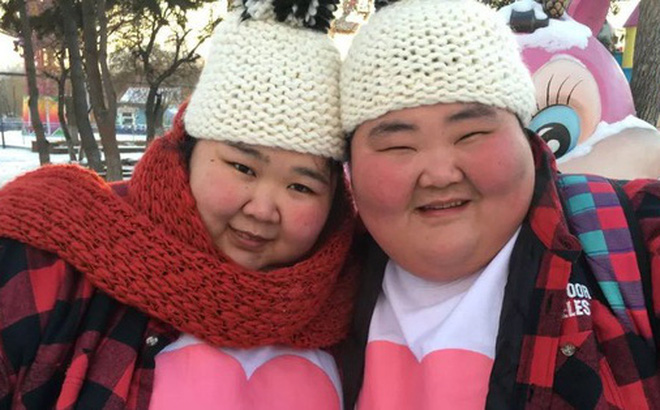Their significant weight made the couple very afraid of climbing stairs and always faced health issues, even purchasing essential items had to be done online.