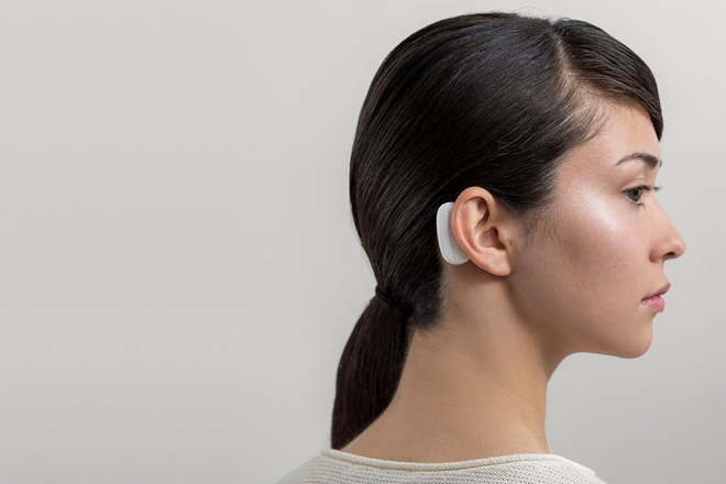 Illustration of the Neuralink system directly attached to the head.