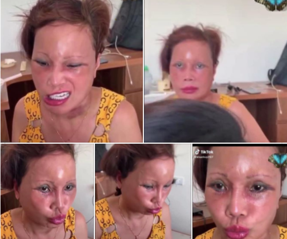 Recent post-surgery images of the 63-year-old bride shocked the online community