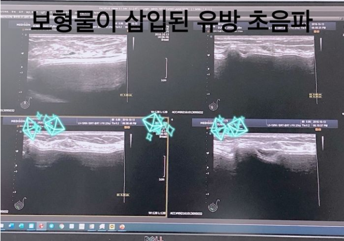 The X-ray results were presented shortly after