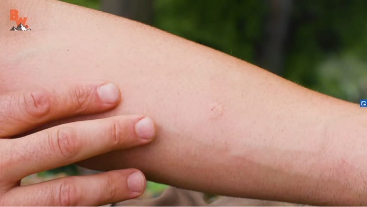 Initially, the sting was this small