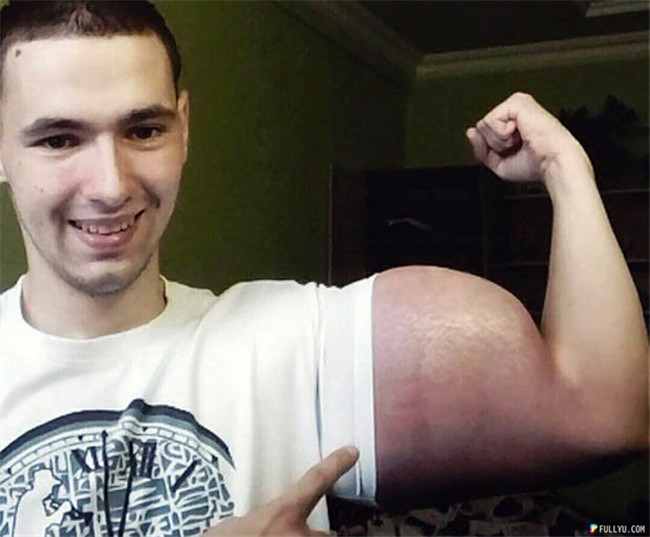 A photo that clearly shows the distortion in Kirill's muscles