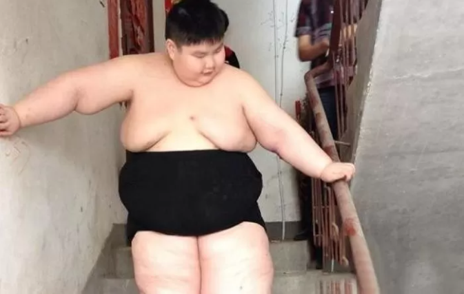 Obesity causes the boy many difficulties in life