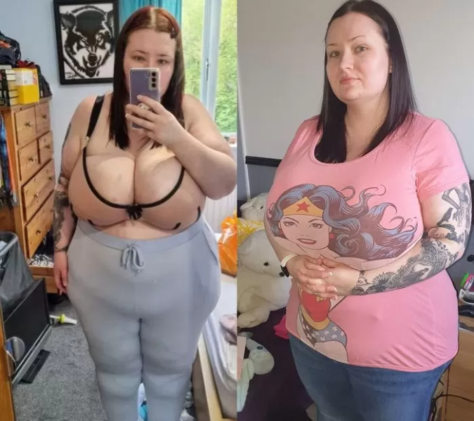 Laura has a massive bust weighing 25kg