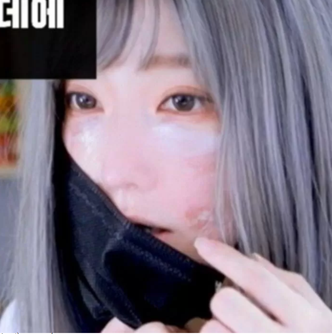 The streamer removes her mask to show her distorted face