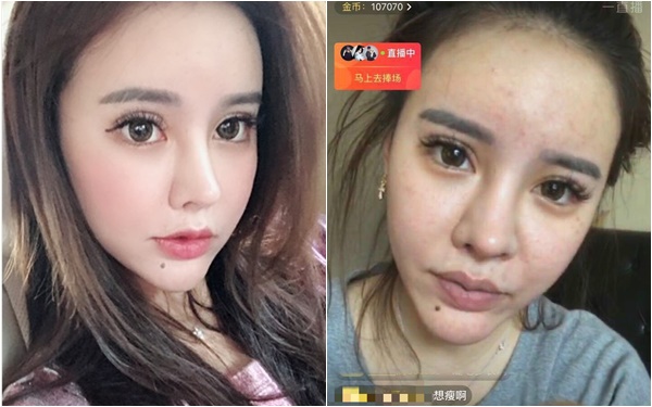 Comparison image clearly depicting the transformation of the two individuals