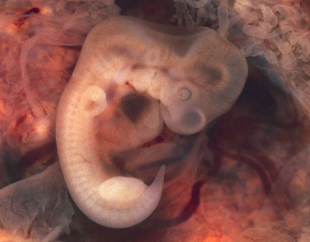 While true tails are remnants of the embryonic tail that were not absorbed back, like this case of a 7-week old embryo with a clearly visible tail.
