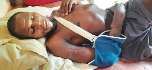 Chimedza - the brave young man who is earning the public's admiration