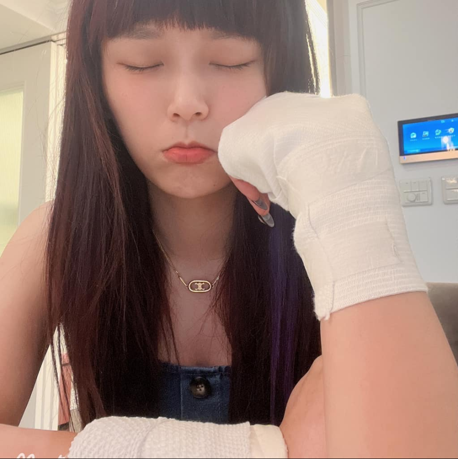 The swollen, bandaged hands of the streamer