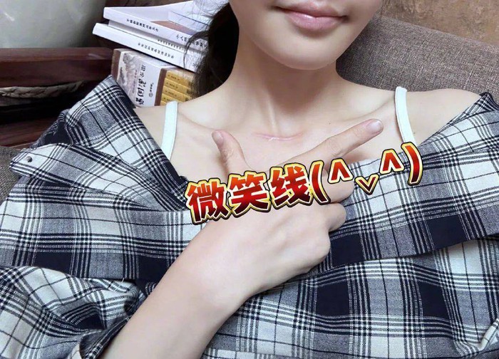 The Life of the Number 1 Female Streamer: How Is She Doing After a Long Absence? 7 The photo she shared shows the long scar after the surgery.