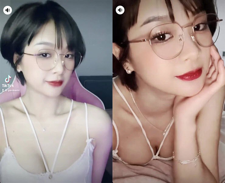 In Response to Fans' Interest, Gấm Kami Shares Her Reasons for Wanting to Get Surgery 1 picture 9 1678803064 807 width740height603 1716521403074584068500