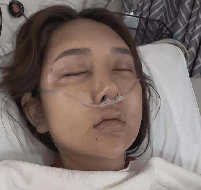 The Female Streamer Who Spent Over 8 Billion for Her Beauty Dream Only to Face Tragedy 1 photo 1722398181272 17223981815331869720921