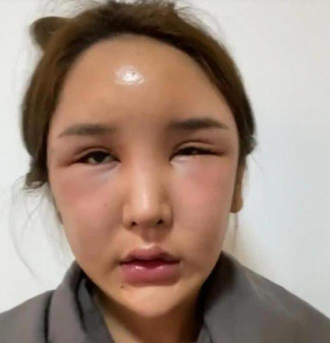 The Female Streamer Who Spent Over 8 Billion for Her Beauty Dream Only to Face Tragedy 2 photo 1722398189662 1722398189749761336301