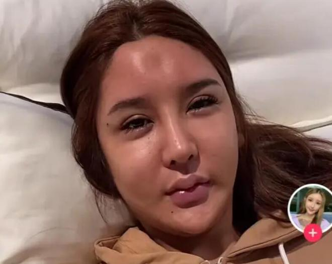 The Female Streamer Who Spent Over 8 Billion for Her Beauty Dream Only to Face Tragedy 3 photo 1722398214646 1722398214820554836653