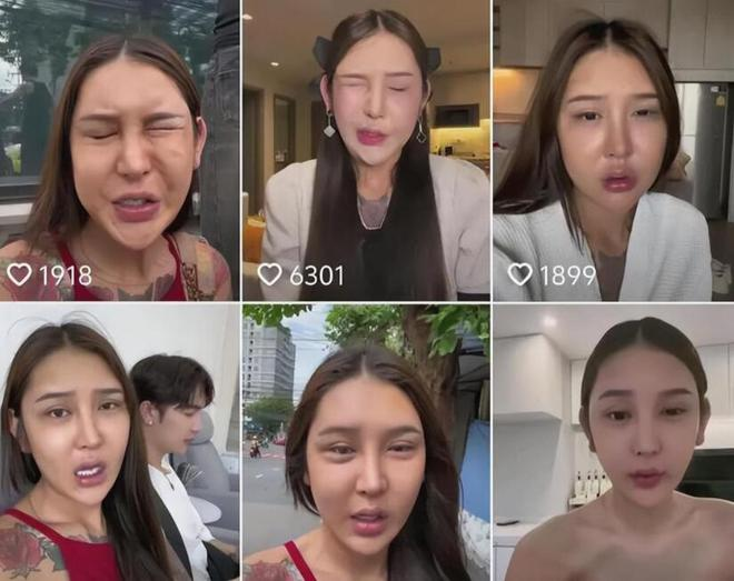 The Female Streamer Who Spent Over 8 Billion for Her Beauty Dream Only to Face Tragedy 5 photo 1722398226817 17223982268981061386315