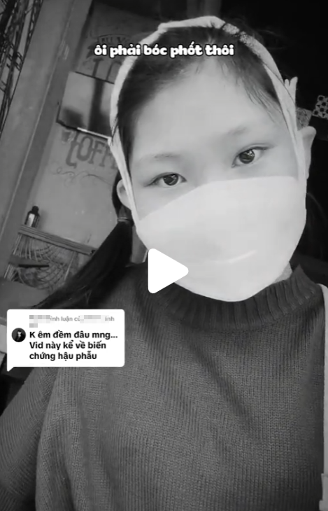 The Beauty of the Female MC After the Major Surgery "Face Reshaping": Still Disappointing Despite Spending Millions? 1 edit screenshot 2024 08 09 161523 17231949439051460105795