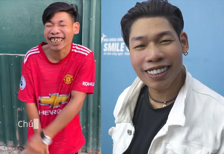 Hot Girl Who Once "Promised to Marry" Thong Soai Ca Appears with a New Look After a Year of Engagement 2 Thong Soai Ca undergoes a transformation.