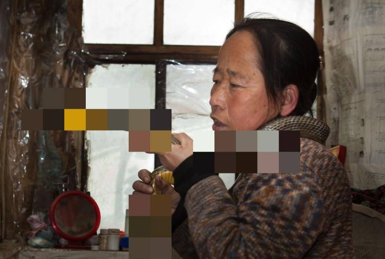 Rescuing a Venomous Snake and Keeping It Close, the Woman Had No Idea It Would Be the Dark Turning Point of Her Life, Affecting Her Entire Family 3 photo 1731559489687 1731559490006173967329