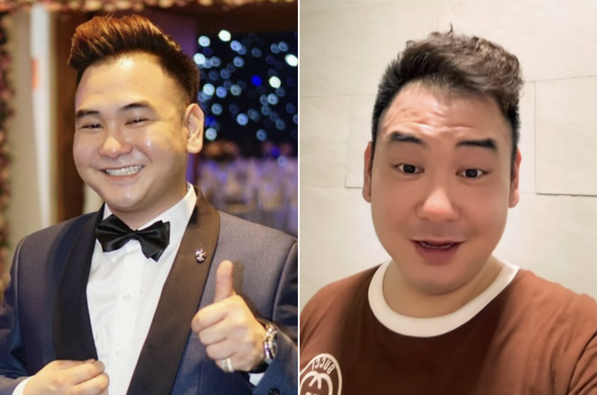 Xemesis Loses 20kg After 3 Months of Turmoil, Current Condition Raises Concerns 3 Netizens are concerned when seeing Xemesis's current images.