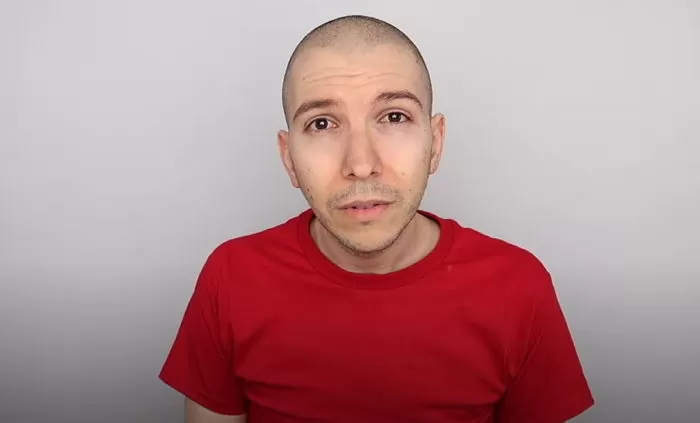 Going All Out for Work, YouTuber Gains 171kg, Uses Ventilator Yet Continues to Make Mukbang Clips and the Outcome 3 photo 1733804529633 17338045299081422465136