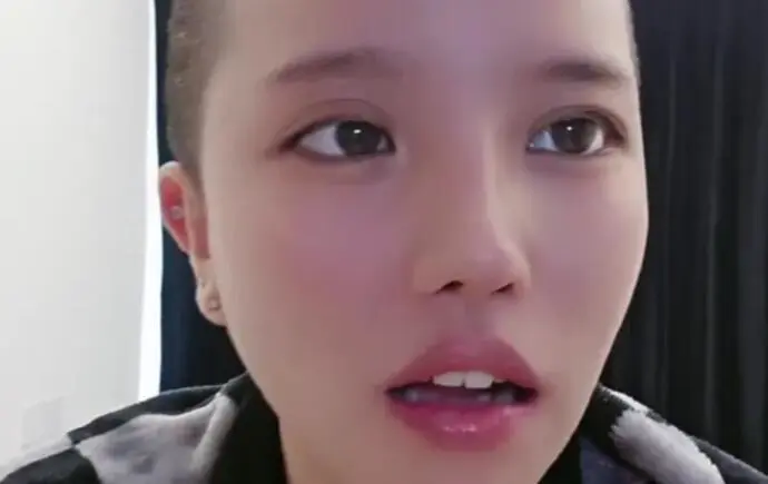 Shocking Female Streamer Goes Live After Skull Surgery 1 photo 1736217563677 17362175641981053989365