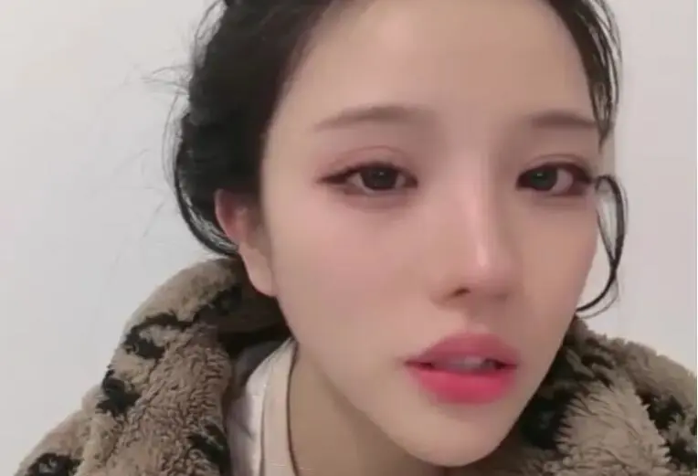 Shocking Female Streamer Goes Live After Skull Surgery 3 photo 1736217597747 1736217599216744800359