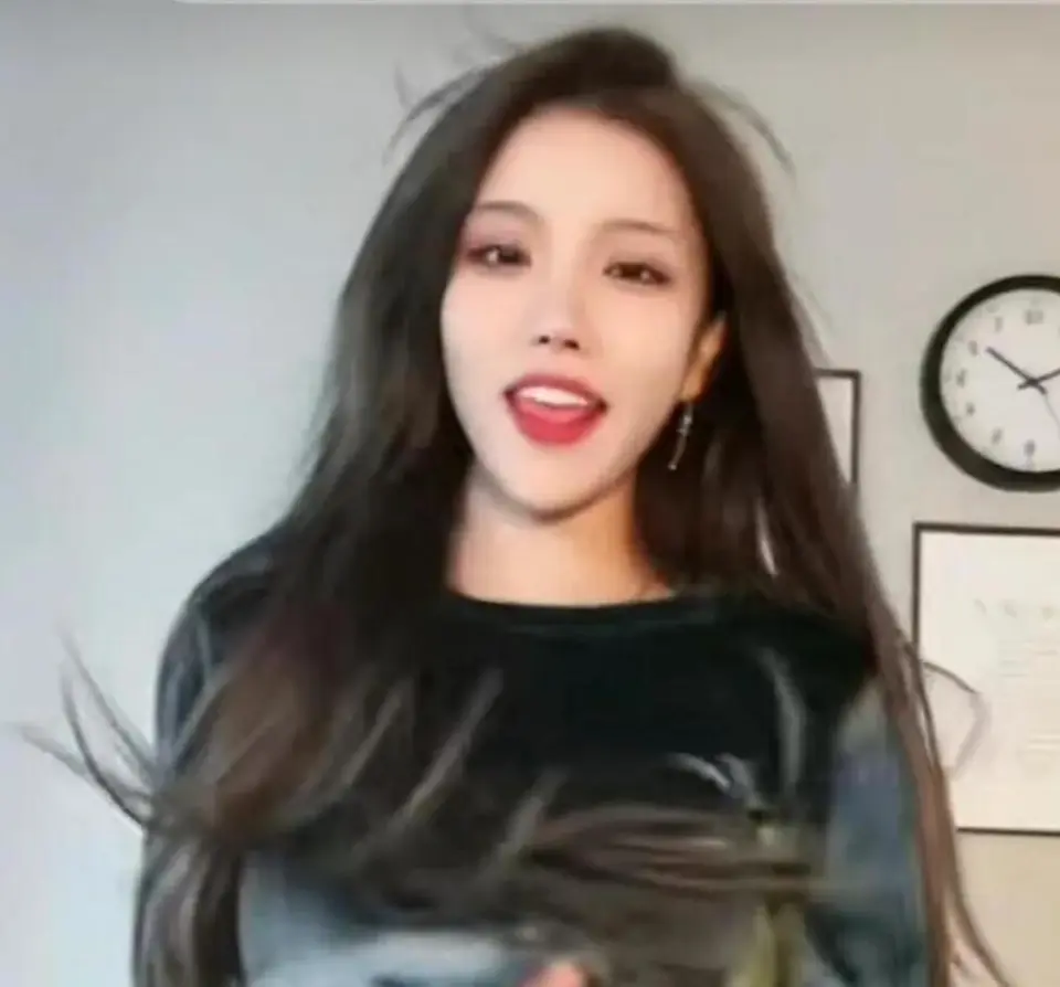 Shocking Female Streamer Goes Live After Skull Surgery 4 photo 1736217603619 17362176038512058028742