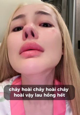 Queen of Aesthetics Ngân 98 Faces Painful Incident, Reveals Next Surgery 3 screenshot 2025 01 02 134518 1735800563587910710317