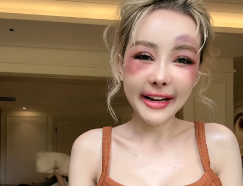 Queen of Aesthetics Ngân 98 Faces Painful Incident, Reveals Next Surgery 5 Not shy about her personal life, the DJ is open and comfortable sharing publicly on social media.