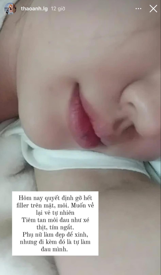 Vietnam's Hottest Seraphine Decides to Remove All Cosmetic Enhancements 4 edit cda5d981 18ae 4214 9f20 442b6b4f5027 1739074902658923872262