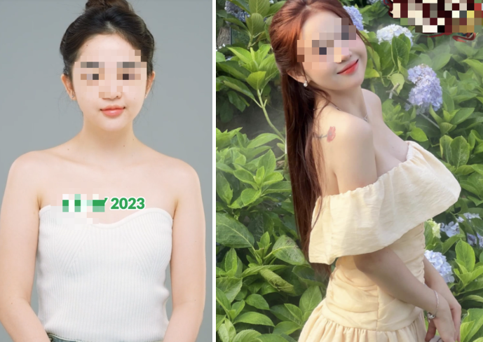Female Streamer Transforms After Breast Surgery, Surprises with Cryptic Rumor 1 screenshot 2025 02 06 140405 1738826578379 17388265788651683903710
