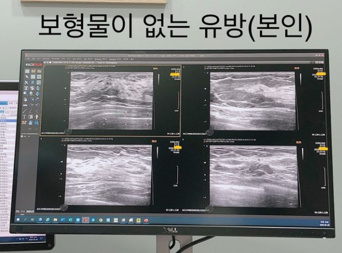 Accused of Plastic Surgery, Female Streamer Boldly Visits Hospital, Livestreams to Prove Her Authenticity 5 screenshot9 1594869125374356808490 1747710298098 17477102981641967171800 1747725684386 174772568452471983098