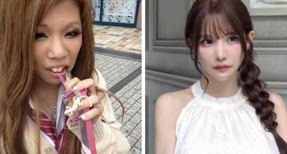 Investing in 100 Cosmetic Surgeries, Girl Satisfied with Her Journey to Becoming a "Super Beauty" 4 edit urlhttp3a2f2fdingyuews126net2f20252f09162f859d1e0cj00t2o83t0020d000v900grm 17580912450251822876262 1758091256205941673585 1758095926629 1758095929311563564356